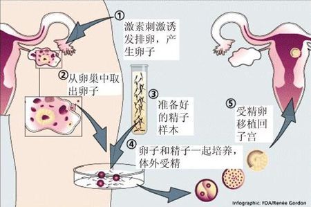 光愈生殖医学中心